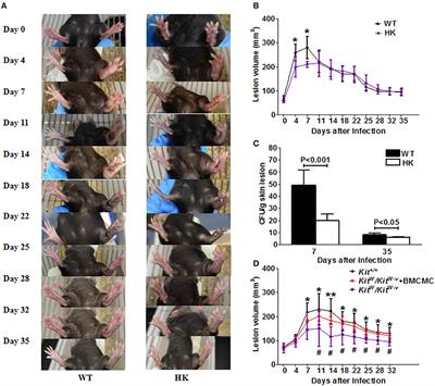 Skin Mast Cells Contribute to Sporothrix schenckii Infection